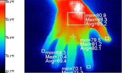 Medical Thermography what is needed to establish a reputable medical thermography imaging center that will benefit both patients and doctors. 